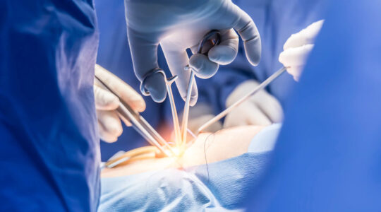 Chirurgies mini invasives