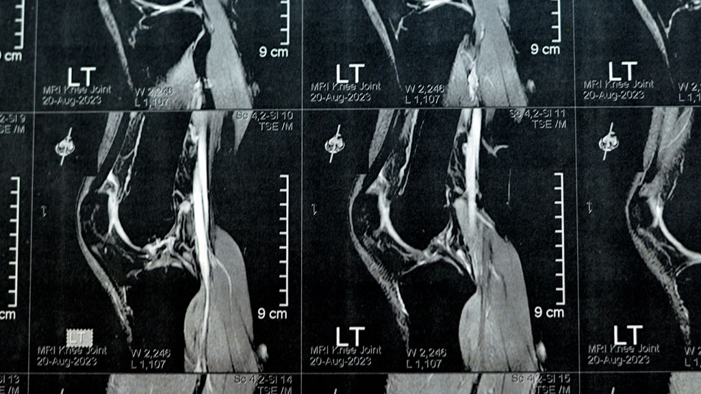 Patient en consultation orthopédique pour diagnostic ligament croisé